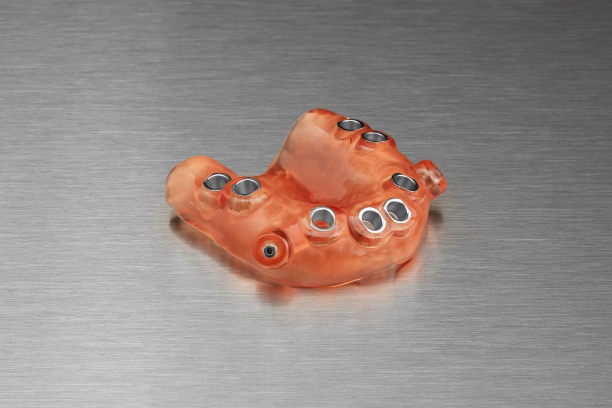 3D-prinitng-Surgical-guides_2/10302018_dental