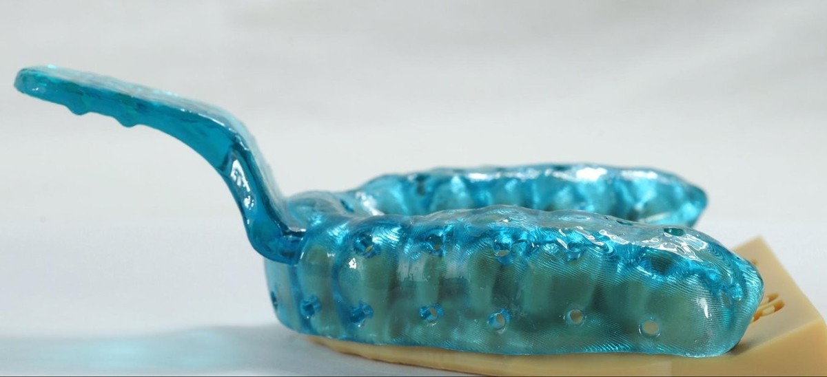 3D-printing-Individual-impression-trays_2/custom-tray-resin
