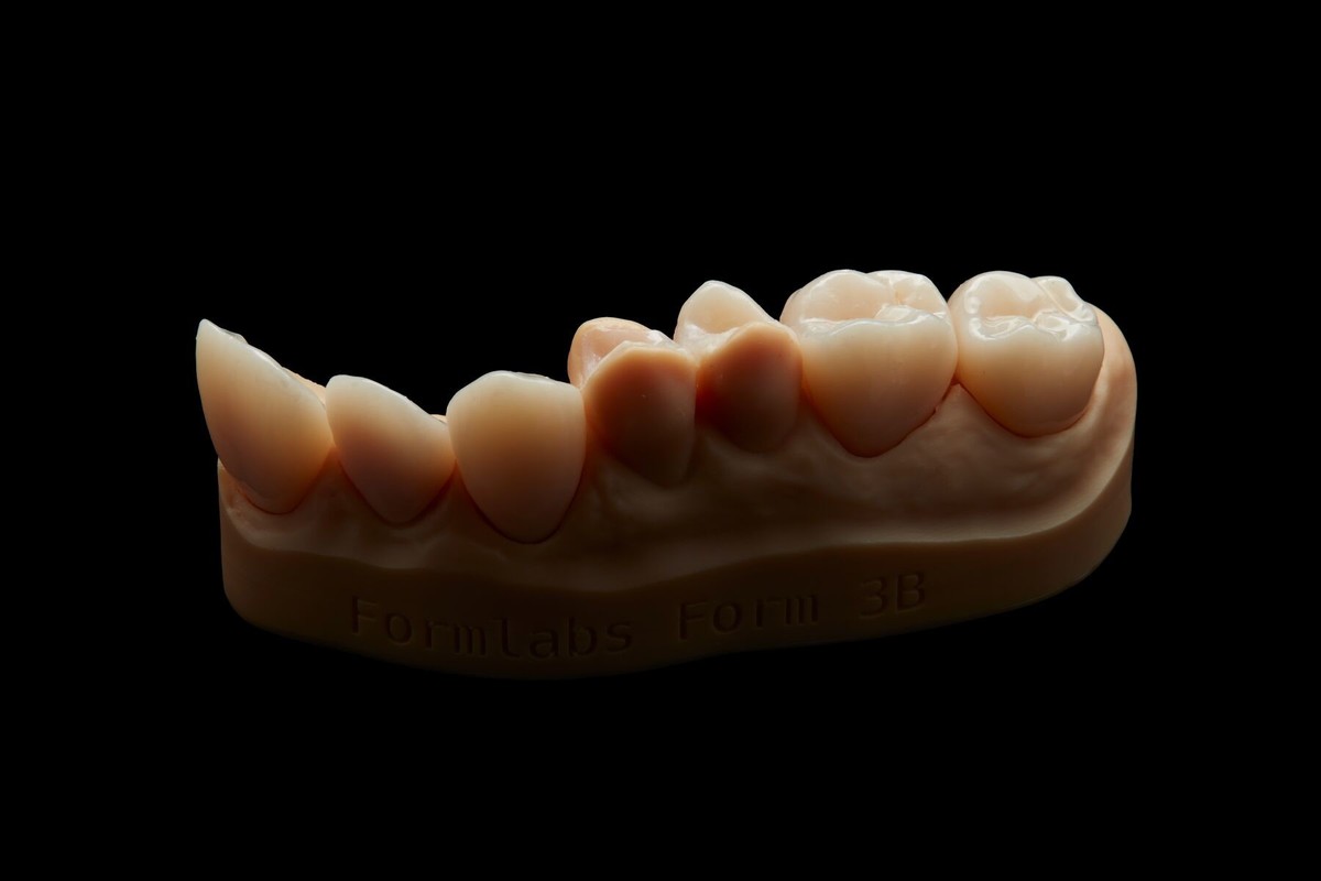 3D-printing-Permanent-restorations_2/Optimized_For_Web_JPEG-Formlabs-2020_-Permanent-Crown-Resin