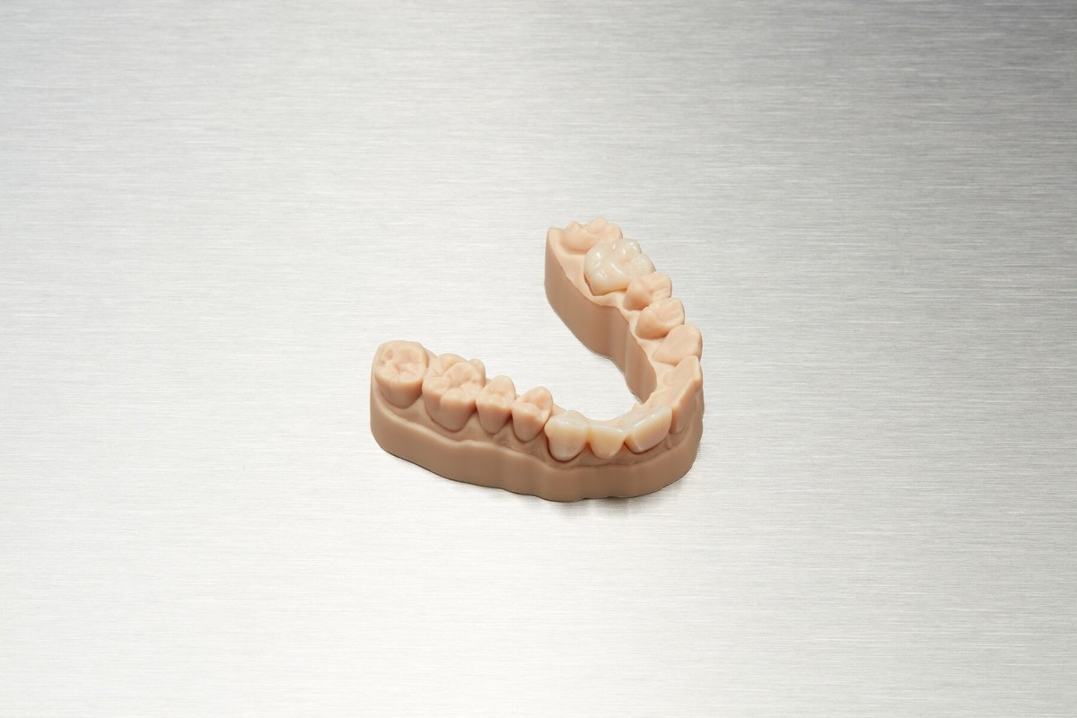 3D-printing-Temporary-restorations_2/Optimized_For_Web_JPEG-06082020_dental-TEMP-CB