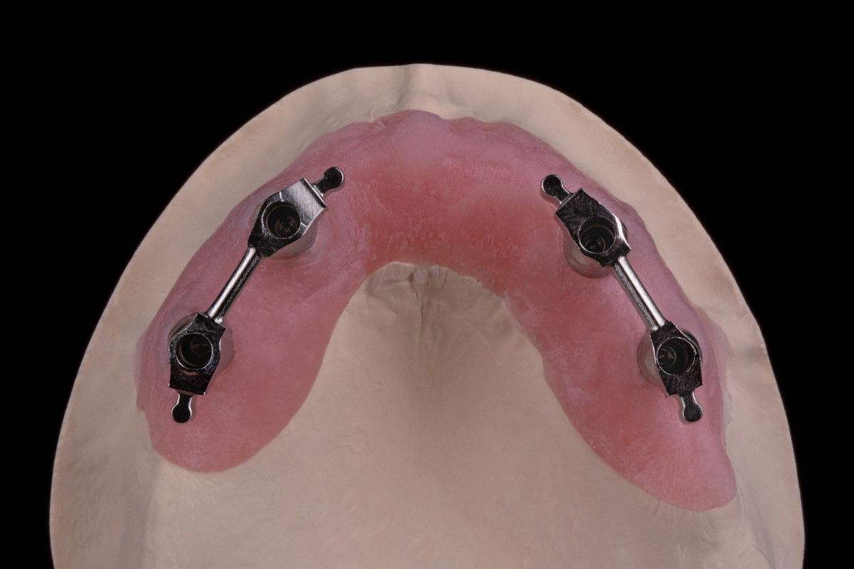 Implant-supported-Bars-milling_1/CoCr-gred-na-implantatih