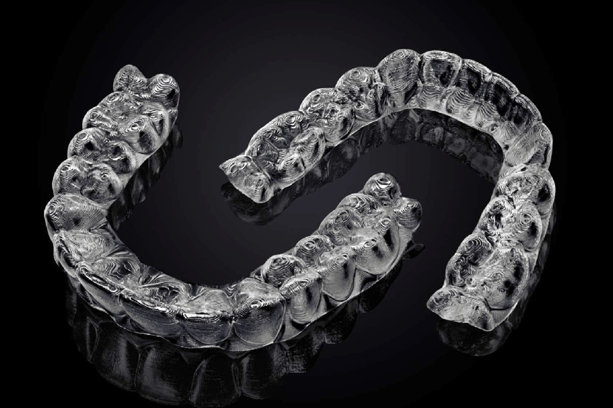 Orthodontc-appliances-service_1/clear-aligners