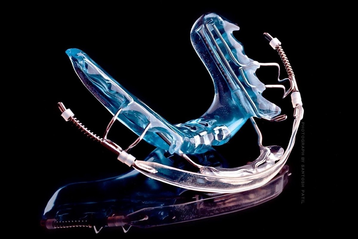 Orthodontc-appliances-service_1/ias-inman