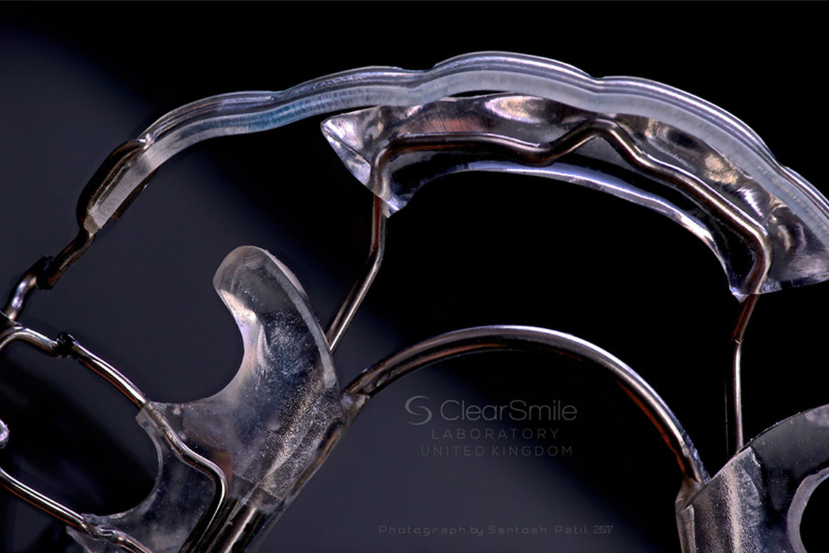 Orthodontc-appliances-service_1/inman-aligner-dr-vuic