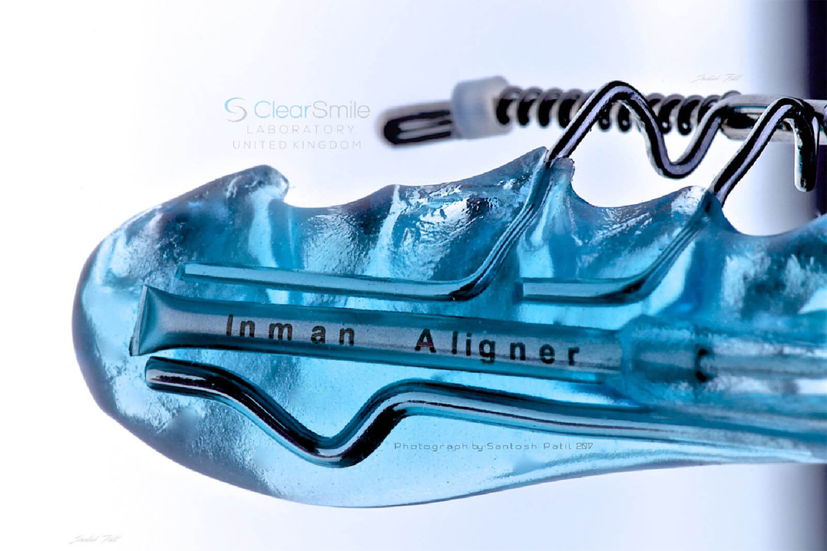 Orthodontc-appliances-service_1/inmanaligner-vuic