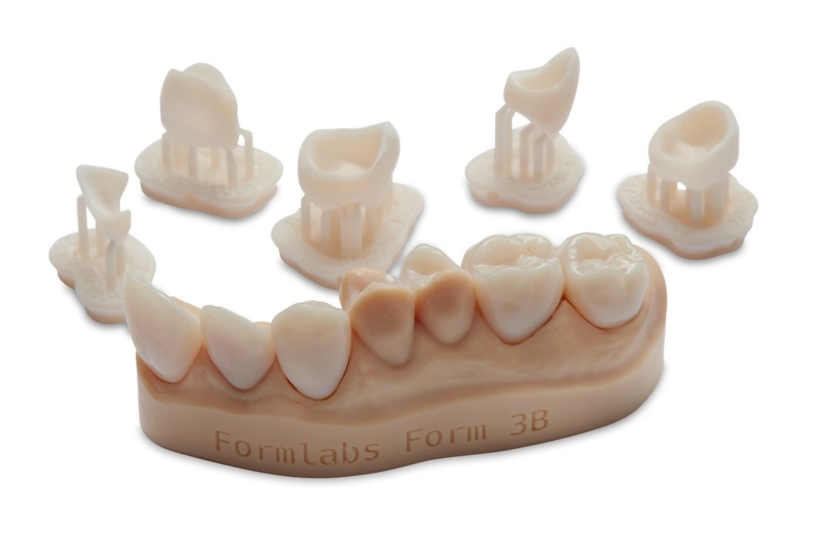 Trajne-restavracije_1/perm_crown.jpgx0_q85_subsampling-2