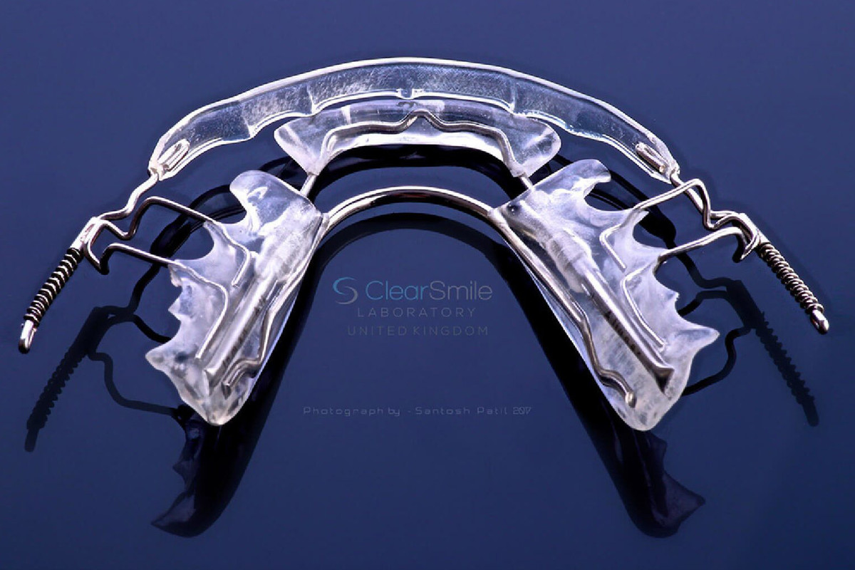 ortodontski-aparati_2/inman-aligner-1600x1040